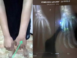 Anggota Respati Polrestabes Surabaya Saat Patroli Diduga Aniaya Anak SMP di Jalan