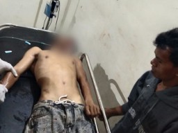 Lagi, Aksi Pembacokan Orang tak Dikenal di Dompu