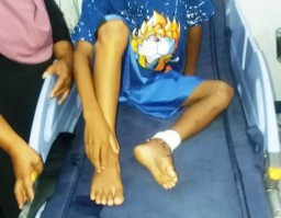 Ada Korban, Pemdes Cuek Jalan Penghubung Rusak