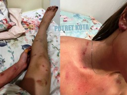 Selebgram Sidoarjo Dihajar Pacarnya Warga Malang