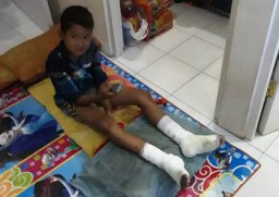 Ternyata Ada Korban Lain Limbah PG Candi Baru