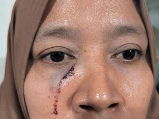 Istri Pekerja Media Jadi Korban Pengeroyokan